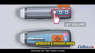 pompa per infusione ambulatoriale